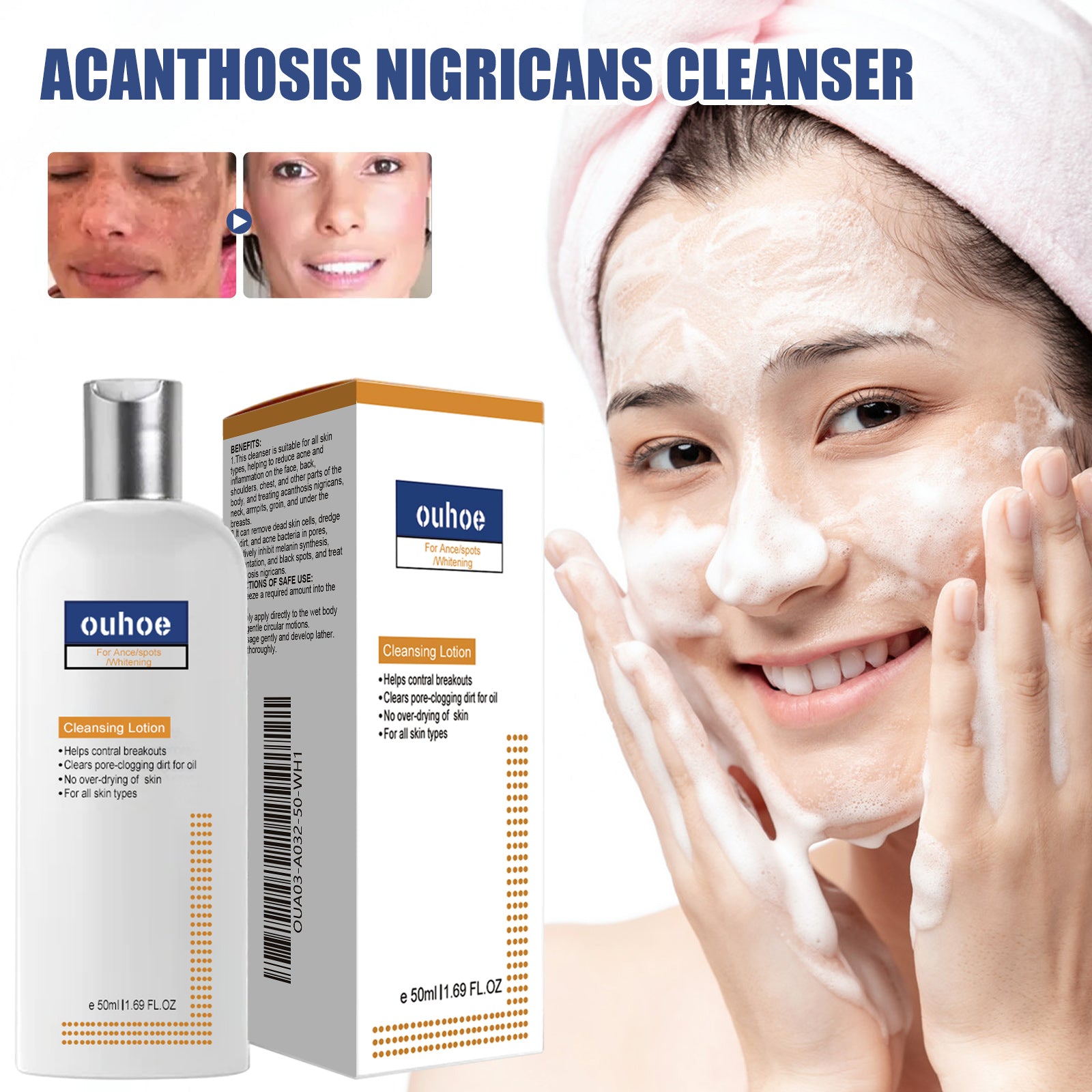 Black Acanthoderm Cleanser Face Deep Clean, Soft And Moisturizing Skin Repair Oil Control Cleansing Cleanser