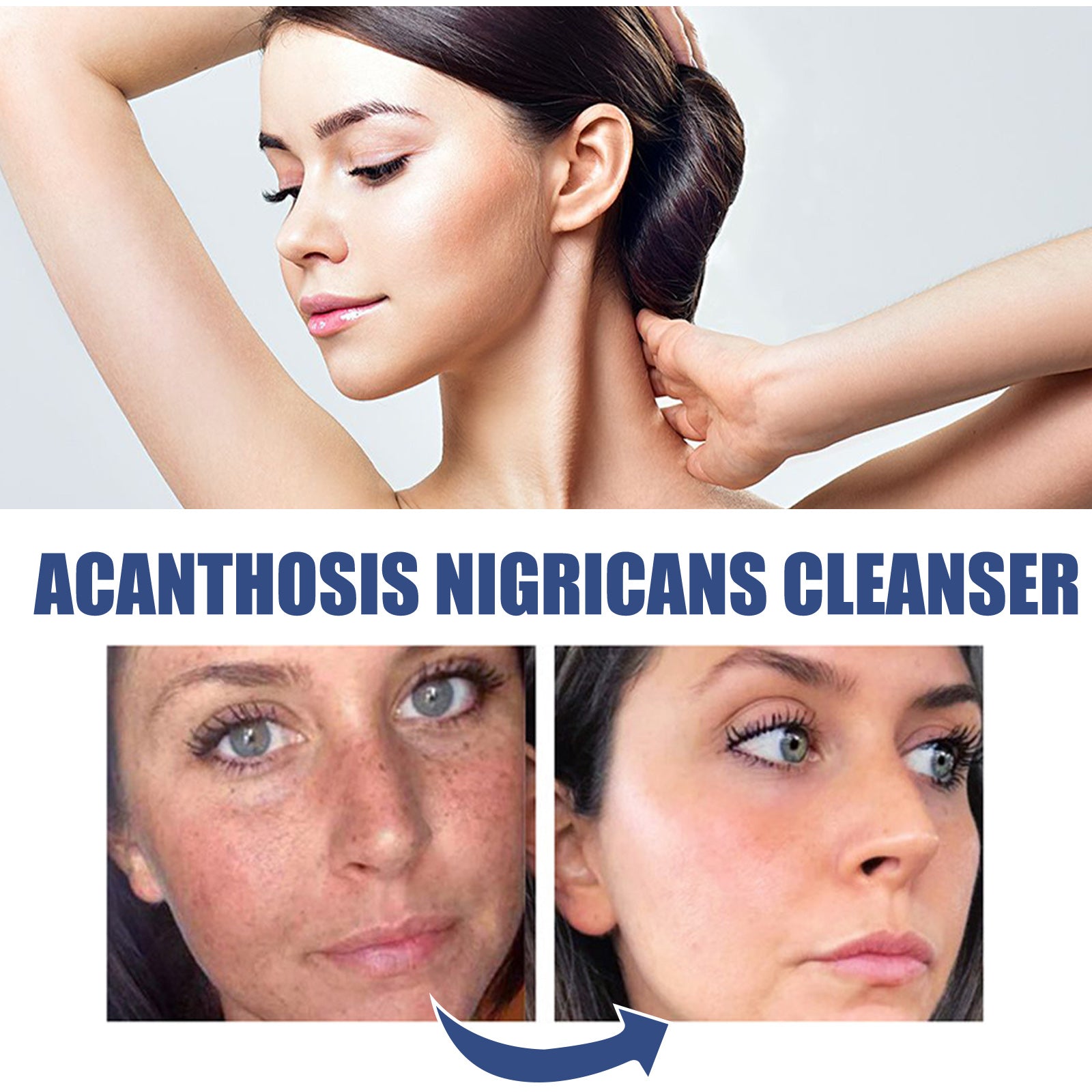 OUHOE Black Acanthoderm Cleanser Face Deep Clean, Soft And Moisturizing Skin Repair Oil Control Cleansing Cleanser